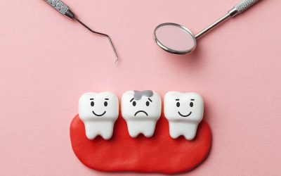 Caries en niños